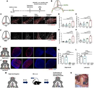 Surgery induces neurocognitive disorder via neuroinflammation and glymphatic dysfunction in middle-aged mice with brain lymphatic drainage impairment